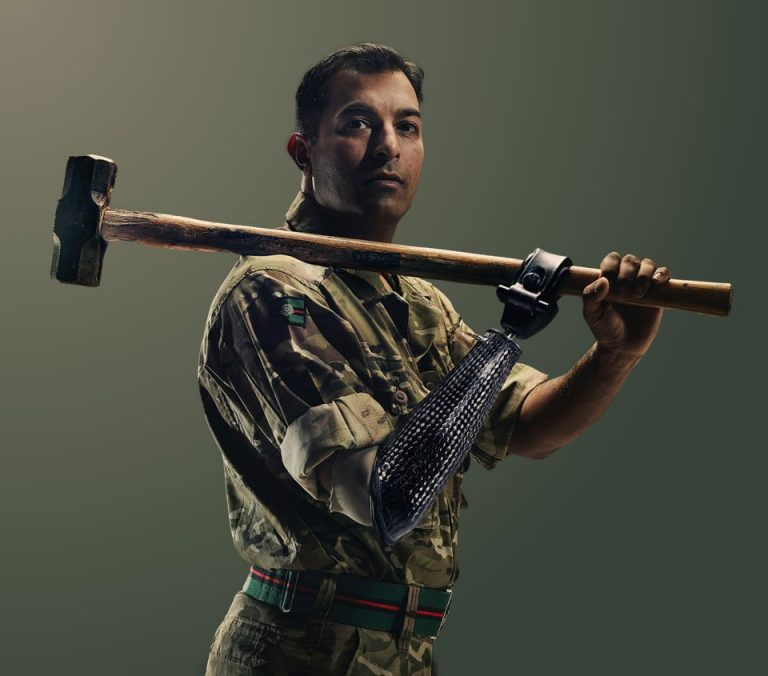 Armed Services Trauma Rehabilitation Outcome Study